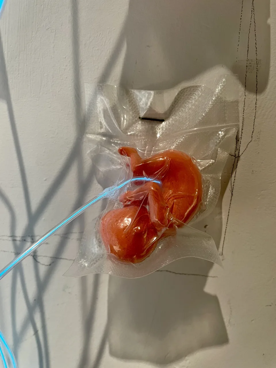 Detail: one vacuum-sealed fetus form, a wire entering the pack.